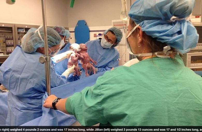 O nascimento das filhas gêmeas, Jenna e Jillian, deixou
Sarah duplamente emocionada. Além da felicidade do parto, as duas nasceram de mãos
dados e surpreendeu a todos na sala de cirurgia. De acordo com o Daily Mail, as
meninas vieram ao mundo na sexta-feira (9), no Akron Geral Medical Center, em
Ohio, nos Estados Unidos
O nascimento das filhas gêmeas, Jenna e Jillian, deixou
Sarah duplamente emocionada. Além da felicidade do parto, as duas nasceram de mãos
dados e surpreendeu a todos na sala de cirurgia. De acordo com o Daily Mail, as
meninas vieram ao mundo na sexta-feira (9), no Akron Geral Medical Center, em
Ohio, nos Estados Unidos