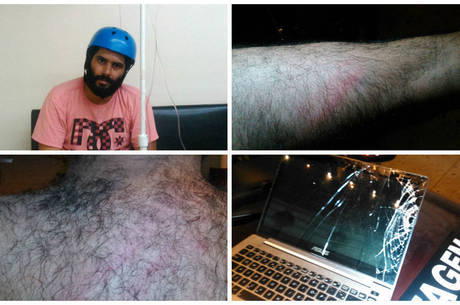 Jornalista foi agredido com golpes de cassetete durante protesto