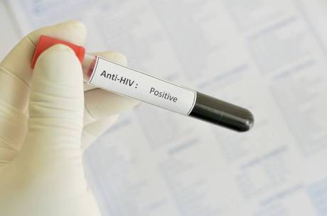 Em 2012, Estado de SP registrou 2.767 mortes por dia por HIV