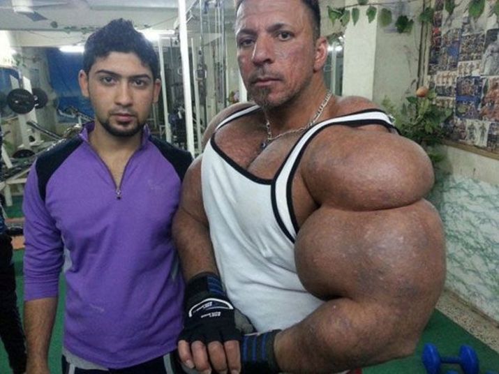Mas é só abrir a camisa e mostrar os bíceps, tórax e abdome inflados e deformados pra gente perceber que esse incrivel Hulk é mais um exemplo da farsa das bombas 