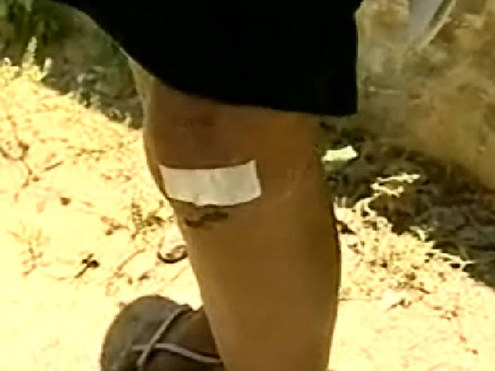 Mesmo existindo pomadas que ajudam a reprimir bactérias depois que você sutura um ferimento ou faz um arranhão, esse novo material pode acelerar o processo de cura