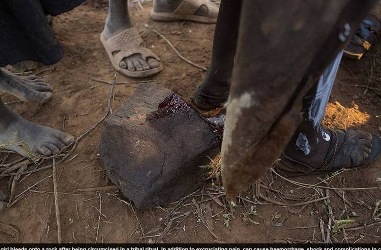  A mutilao genital  sofrida por 140 milhes de mulheres em 29 pases do mundo