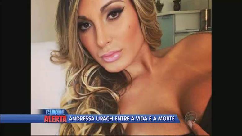 De acordo com boletim médico Andressa está em observação na UTI + Assista ao vídeo! 