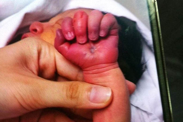 Foi a enfermeira quem encontrou a mãe, no quarto da maternidade, com os dentes sobre as mãos e os bracinhos do bebê. O caso chocante ocorreu em Shenzhen, na província de Guangdong, sudeste da China