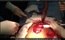 No vídeo, o cirurgião aparece retirando uma piramboia de 60 cm de dentro
 do corpo do homem. Segundo relatos, o paciente teria introduzido o 
peixe pelo ânus