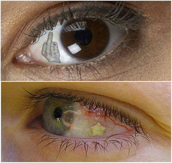 Onde será que vai chegar essa mania de piercings, tatuagens e todas essas modificações? A nova moda é o implante ocular! Essencialmente, um pequeno pedaço de joia decorativa é implantado cirurgicamente no olhoCurta a página do Hora 7 no Facebook e fique por dentro de todas as modificações corporais do mundo 