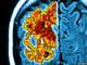 O estudo, publicado no Jornal de Neurociência (Journal of Neuroscience), foi liderado  por Matthew Kan, que realiza o MD/PhD no laboratório da professora Colton