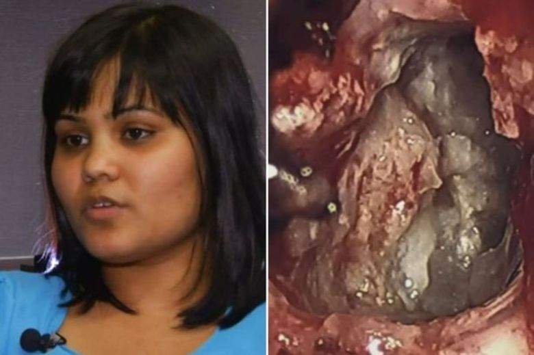 A jovem indiana Yamini Karanam, de 26 anos (na foto), tem uma histria de vida no mnimo inusitada. Afetada por uma 'doena misteriosa' que os especialistas acreditavam ser um tumor, ela foi submetida a uma cirurgia de emergncia no crebro