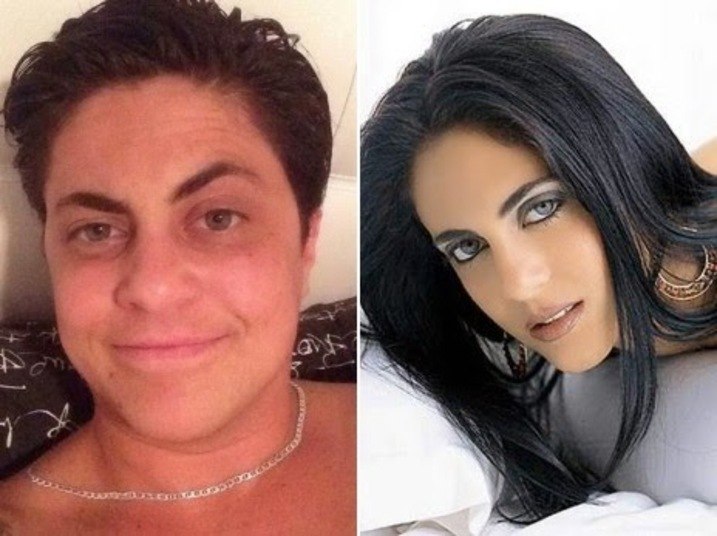 Filha De Gretchen Antes E Depois