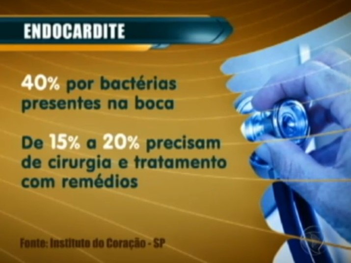 A endocardite é responsável por uma alta morbidade e por significativas tazas de mortalidade.Em torno de 20% dos doentes não sobrevivemNo R7 Play você pode assistir ao Fala Brasil na íntegra! Clique e experimente de graça!+ Uma simples cárie pode matar; veja 