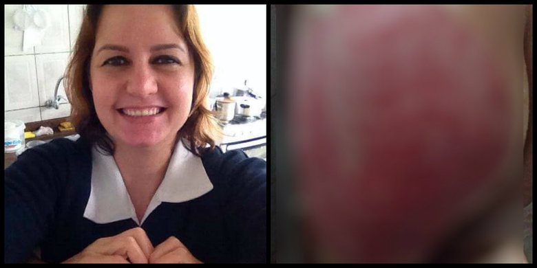 Daniela Desa Avighi, de 36 anos, morreu por infecção generalizada na última quinta-feira (2), nove dias depois de passar por um procedimento estético para retirar estrias, em Praia Grande, litoral sul de São Paulo. De acordo com a família, a cirurgia pode ter sido responsável pelas complicações e a morte da vítima*Colaborou Brenno Souza, estagiário do R7