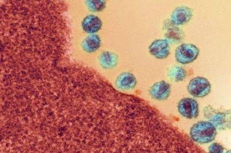 Tratamento com antirretrovirais não consegue atingir HIV 'oculto'