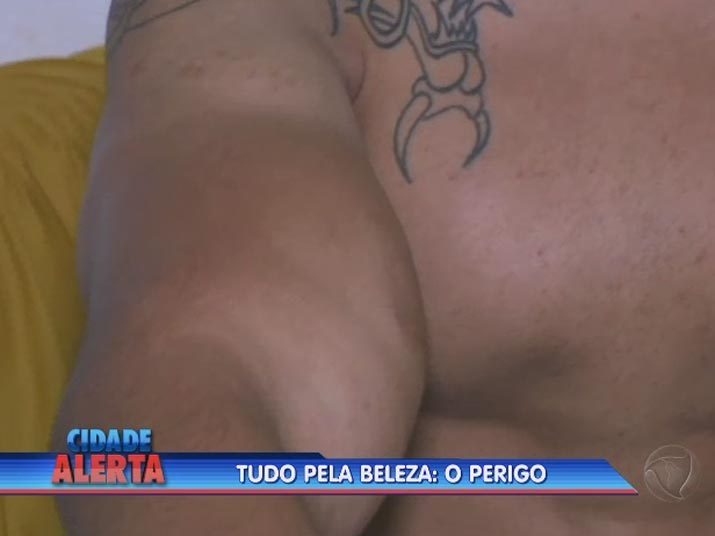 Ainda de acordo com a reportagem, começaram dores, febres, falta de apetite e vários hematomas pelo corpo. +Quer ver tudo o que rolou no Cidade Alerta? Veja a íntegra no R7 Play 
