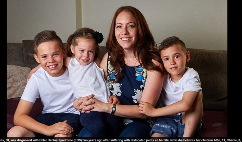 A doença faz com que o tecido conjuntivo, que apoia a pele,
os tendões, ligamentos, veias, ossos e órgãos é mais fraco do que o normal.
Isso faz com que ela se lesione com qualquer tipo de atividade, por isso ela
precisou largar o emprego, já que sempre se machucava nas atividades que
realizava como enfermeira. 
— Uma vez eu estava indo para a balada com uns amigos e
desloquei o joelho. O segurança da balada não acreditou em mim e não me deixou
entrar porque achou que eu estava muito bêbada para entrar na festa