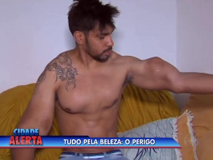 Com mãos e braços inchados, o jovem terá que passar por cirurgia para retirar o líquido.+Quer ver tudo o que rolou no Cidade Alerta? Veja a íntegra no R7 Play 