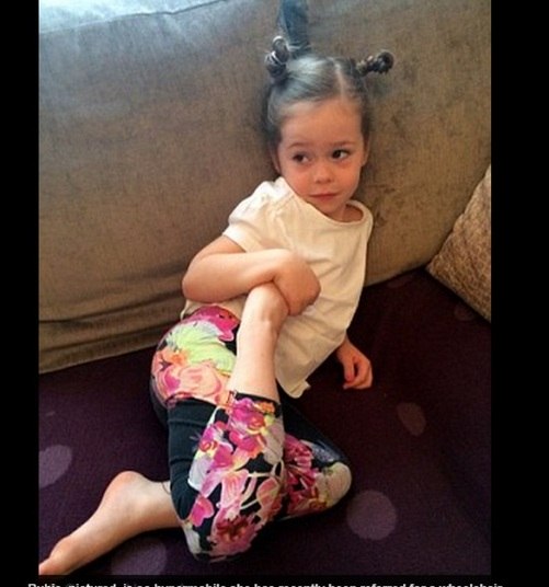 Ela acredita que os três filhos, Alfie, de 11 anos, Charlie,
de oito, e Rubie, de cinco, sofram com a mesma doença, já que “as crianças são
impressionantemente elásticas e fazem posições de assustar”. 
— Nos últimos seis meses, já levei meus filhos mais de vinte
vezes ao hospital. Alfie já recebeu o diagnóstico e Rubie precisou usar cadeira
de rodas recentemente. Todos eles são muito elásticos. Isso me preocupa, porque
vejo que eles terão o mesmo problema que eu