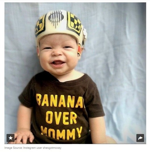 Mesmo fazendo sucesso entre
os familiares e amigos, o pai conta que Jonathan nunca pareceu ligar muito para
os capacetes.— Eles não tinham muita
ventilação, então havia dias em que ele ficava muito bravo com o calor, e então
ficava com calor porque estava bravo, e por aí vai