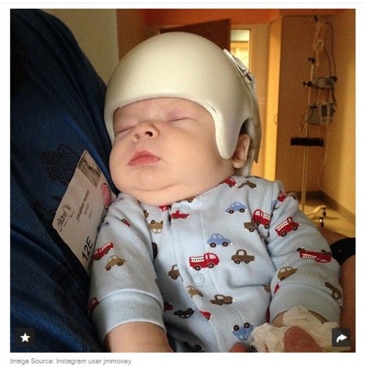 Quando o choque da cirurgia
já havia passado, o pai de Jack, Honathan, decidiu que os capacetes brancos
dados pelo hospital para a família eram muito sem graça, e resolveu que podia
fazer algo para mudar isso