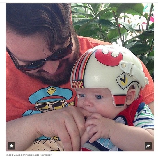 Depois de ouvir o
diagnóstico, os pais de Jack optaram por uma cirurgia pouco invasiva ao invés
de um procedimento radical, o que, no entanto, exigiria que o bebê usasse um
capacete por no mínimo 22 horas por dia até que ele completasse um ano de idade