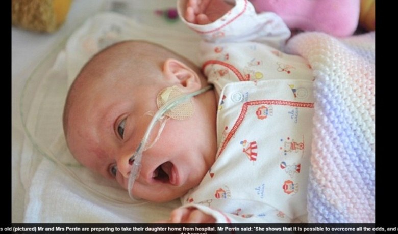 

Hoje com 2,5 kg, a pequena foi liberada pelos médicos e
poderá conhecer o novo lar.
— Era tudo o que mais queríamos. Sempre foi muito difícil
chegar em casa e saber que ela estava no hospital, correndo risco de não
sobreviver

