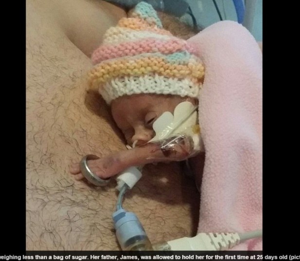 

A imagem impressionante mostra o primeiro momento em que
Mollie Perrin foi para o colo do pai. A menina nasceu prematura, com somente 13
semanas, e era tão pequena que seu braço passava pela aliança do pai. De acordo
com informações do site DailyMail, os médicos deram apenas três semanas de vida
para o bebê

