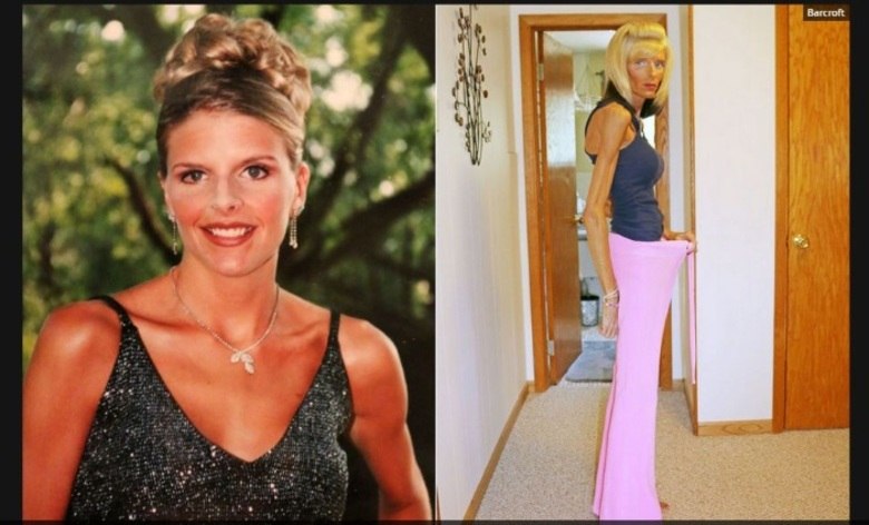 

A ex-modelo, Lisa Brown, de 32 anos, está “morrendo de fome”
por causa de uma doença rara que não permite que ela coma alimentos sólidos. Segundo
informações do site Mirror, ela perdeu mais de 25 kg em dois anos

