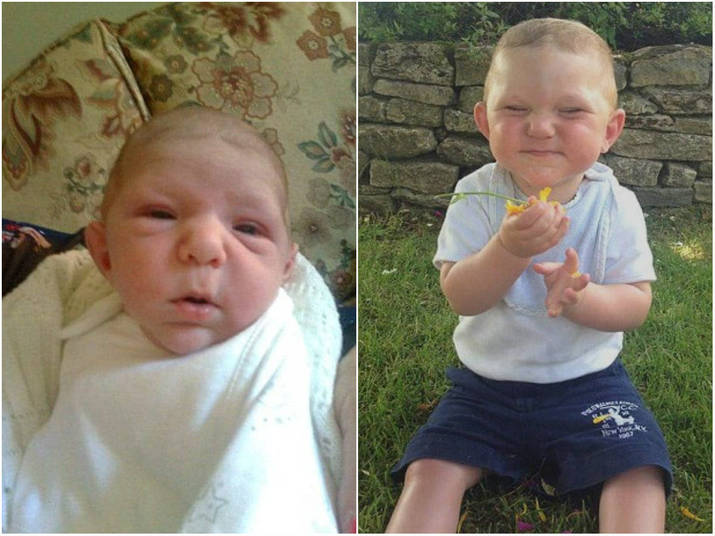 Charlie Stanbury, 3 anos, foi diagnosticado com gigantismo, uma condição genética muito rara que compromete até mesmo o seu comportamento. Além disso, o menino também sofre com sopro no coração, tamanho dos rins alterados, membros assimétricos e estrabismo em um dos olhos