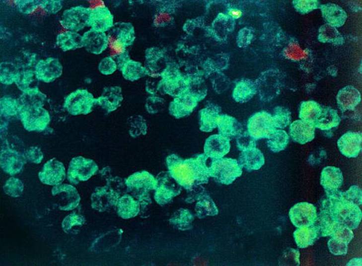 A ameba entra no corpo humano por meio da mucosa nasal, indo até o sistema nervoso central e matando a pessoa em um curto período, em geral, entre 10 e 12 dias A ameba entra no corpo humano por meio da mucosa nasal, indo até o sistema nervoso central e matando a pessoa em um curto período, em geral, entre 10 e 12 dias