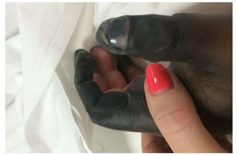 

A mulher luta pela vida do marido e pede aos diretores do
hospital em Manchester, na Inglaterra, que consigam um leito para tratar
Matthew.

— Ele precisa de cuidado para ter chances de sobreviver. É a
única coisa que eu posso fazer. Pedir ajuda

