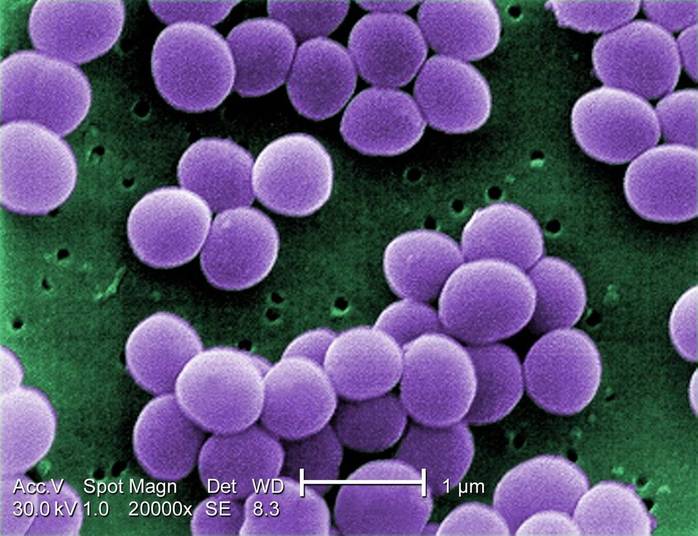 O estudo foi feito com bactérias staph e E.coli. Com a Escherichia coli, notaram que a bactéria não se prendia aos filamentos menores do que ela. Já no caso do Staphylococcus, a bactéria ficou presa na bandagem bem rápido