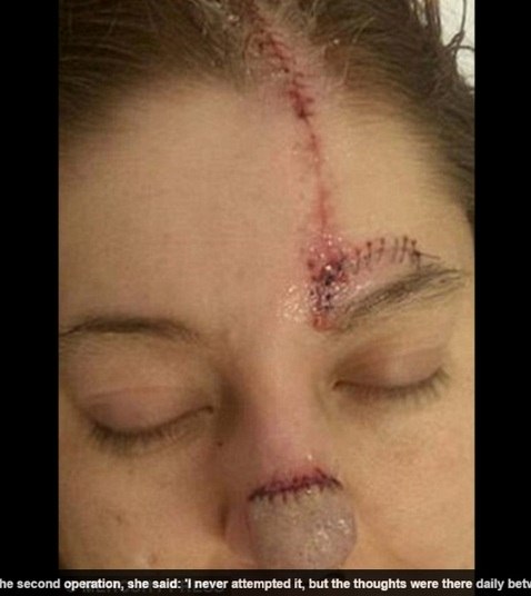 Hoje, Bree vai a um psicólogo para tentar recuperar o amor
próprio que o câncer tirou