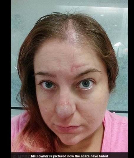 — Estar em público me deixa tensa. Eu fico lembrando de como
as pessoas me olhavam. Me tornei extremamente ansiosa por causa disso
