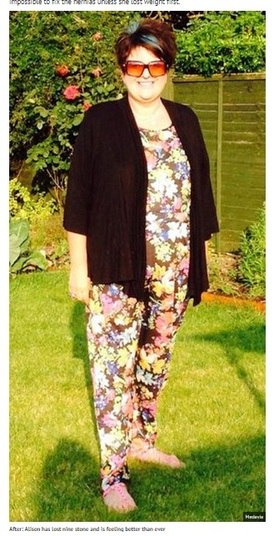 Desesperada,
ela procurou a ajuda de médicos, mas todos disseram que seria impossível
consertar suas hérnias a menos que ela perdesse peso antes. Em setembro de
2013, ficou decidido que Alison passaria, simultaneamente, por uma cirurgia bariátrica
e também pela correção das hérnias, tudo na tentativa de prevenir que ela
passasse pelo mesmo problema no futuro.

— Quando acordei da operação, olhei para minha barriga, que estava
consideravelmente menor. Voltei para casa dias depois, mas comecei a me sentir
letárgica e vomitava o tempo todo