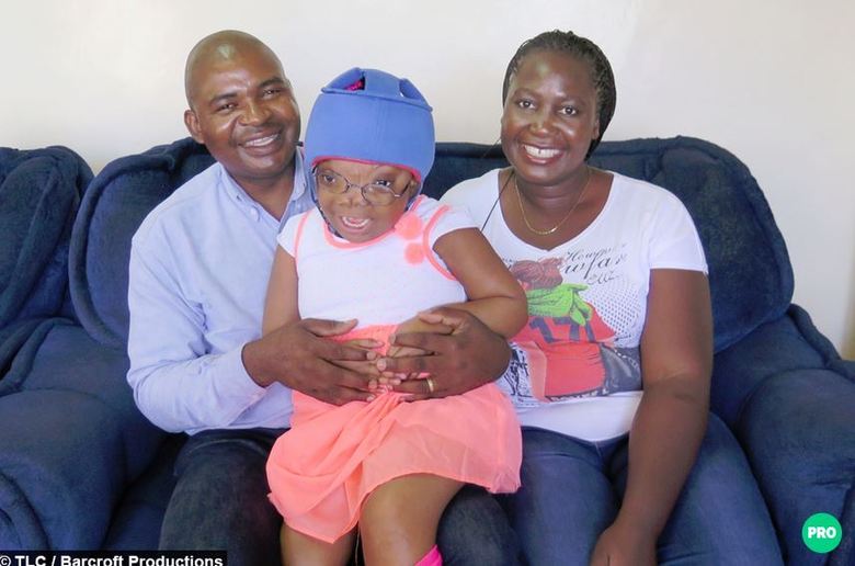 A mãe, Ngula, e o pai Elijah, descobriram que a menina nasceria com a deformação durante a gravidez e ficaram desesperados.— Quando ela nasceu, nós não conseguimos nem vê-la direito e já a levaram para tratamento intensivo. Ficamos com muito medo, porque os médicos diziam que o caso estava acima do que eles poderiam fazer