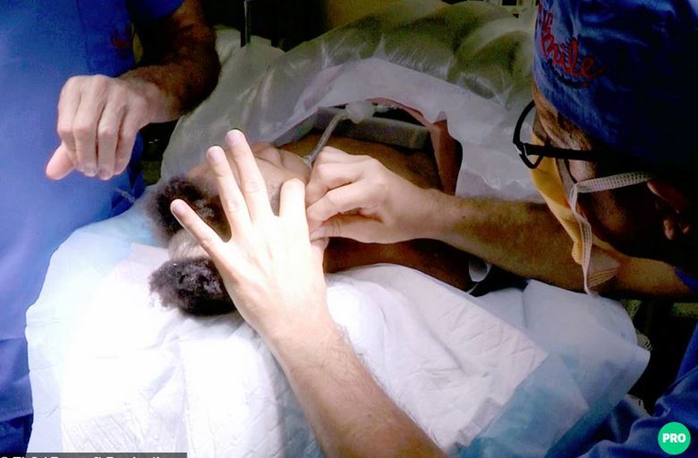 Qualquer queda ou impacto mais forte poderia mata-la, já que seu cérebro estava completamente desprotegido