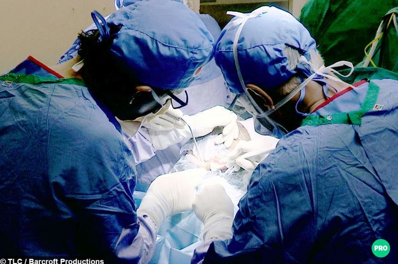 A menina passou pela cirurgia,
na qual os médicos implantaram uma parte da testa em 3D, para incentivar o
desenvolvimento dos ossos na região da cabeça