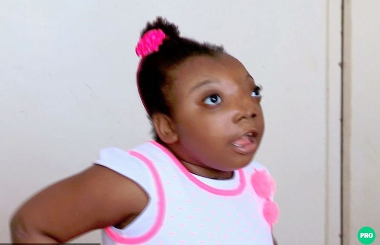 Aos três anos de idade, a menina e os pais viajaram à Argentina para uma primeira cirurgia. Depois de meses de tratamento nutricional, para que ela ganhasse tamanho e peso, Ndola passou por uma operação de 21h para colocar o cérebro no lugar certo e começar a reconstrução facial, explica Kenneth Salyer, fundador da Fundação Mundial Craniofacial.— A cirurgia foi emergencial, porque ela não conseguiria sobreviver daquele jeito