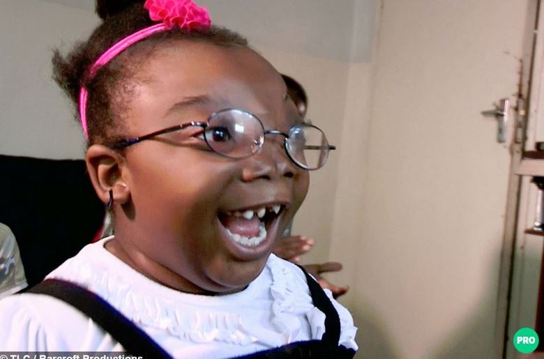 Em maio deste ano Ndola e a mãe
viajaram à África do Sul para outra reconstrução facial. O implante
servirá com um “guia” para que os ossos se desenvolvam no lugar certo, explica Salyer