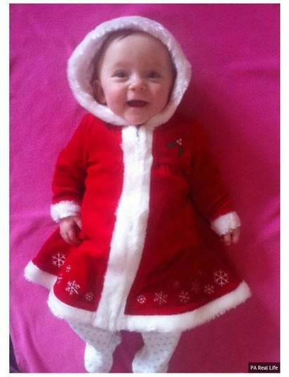 Hope nasceu prematura porque a bolsa de Tracie se rompeu antes da hora.
Três dias antes do parto, a mãe foi internada no hospital de Heartland, na
Flórida, Estados Unidos. 

A gerente de supermercado de 32 anos contou ao jornal The Mirror que,
como a bebê não apresentava sinais de sofrimento, ela foi mandada de volta para
casa. 

— No entanto, eu acordei com muita dor e pedi para o meu noivo, Mark, para
me levar de volta ao hospital. Lá, fizeram uma cesárea e a Hope nasceuLuta pela vida: bebê prematuro morre quatro dias após o nascimento e irmão gêmeo tenta sobreviver