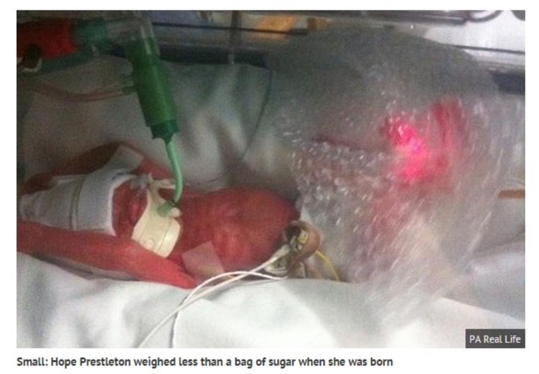 No entanto, o destino surpreendeu a todos, e deu uma nova chance à
garotinha. Sua mãe contou que a batalha pela sobrevivência foi vivida dia a
dia, e que a família toda se manteve unida e com esperanças.— Os médicos disseram que ela era muito forte. Ela se recuperou das paradas
cardíacas sozinhas, sem ajuda médica. Por isso, comprei para ela uma roupinha
do Super-Homem. A roupa não serviu até quando ela teve alta e pôde voltar para
casa conosco. Ela era forte, mas minúscula