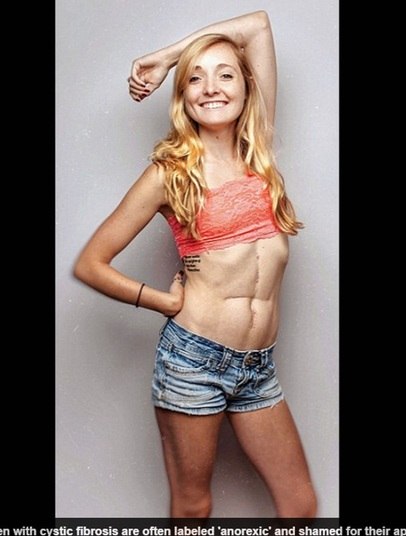 O profissional começou as sessões de fotografia há um ano, e
conta que quatro das mulheres já morreram