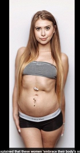 O fotógrafo decidiu fazer o livro quando viu uma entrevista
na televisão, de uma pessoa que tinha vitiligo e estava chamando atenção para a
doença