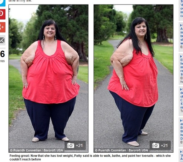 Com 219 kg, Patty conseguiu eliminar 107 kg com uma dieta balanceada de 3.000 calorias ao dia. Orgulhosa de si mesma, ela diz que sua mudança a ajudou a aumentar sua autoestima e, também, o seu relacionamento com seus filhos.— Agora eu posso fazer coisas que as pessoas não dão valor, mas que eu não conseguia fazer: andar, tomar banho e pintar minhas unhas do pé. Meus filhos estão muito orgulhosos pelo fato de que eu dei uma reviravolta na minha vida. Temos um relacionamento muito melhor agora. Para as mulheres que estão em um relacionamento como o meu com meu ex-namorado, é preciso ver se você está fazendo isso apenas para satisfazer os desejos do homem ou para você mesmo. Eu não tenho nenhum arrependimento porque eu me dei conta a tempo e salvei a minha vida