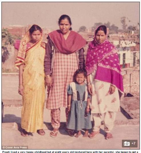 Preeti, que mora na cidade de Faridabad, no norte da Índia, viveu
uma infância muito feliz até os oito anos, quando sua coluna começou a entortar
e ela começou a ter uma corcunda. 
— A vida se tornou muito mais difícil do que eu
estava acostumada. Comecei a ficar torta para o lado e não podia sentar direito