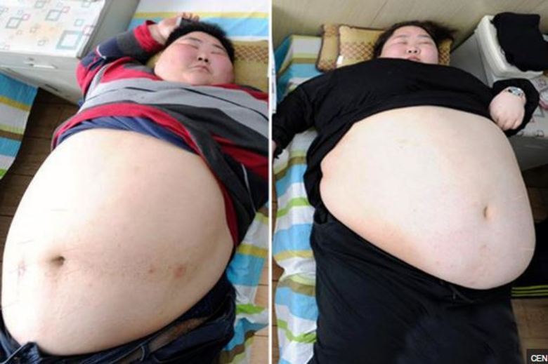 Um casal chinês, que juntos pesam mais de 400kg, terá de
passar por cirurgia de redução de estômago para conseguir fazer sexo. A
obesidade não permite que eles consigam um contato tão próximo entre eles. As
informações são do site DailyStar
