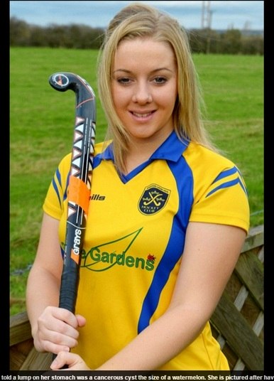 Uma jovem que parecia grávida de oito meses ficou perplexa ao descobrir
que sua barriga inchada era causada por um cisto gigante, do tamanho do melão e
mais pesado que um bebê recém-nascido.
A semelhança com uma gestação era tão grande que os médicos do
pronto-socorro em Hull, na Inglaterra, acharam de fato que ela esperava um
filho quando ela deu entrada na emergência agonizando de dor. Só depois de
exames de imagem foi possível determinar que a criança era, na verdade, um
tumor no ovário esquerdo, preso também a um imenso cisto

