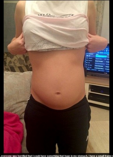 A primeira vez que Olivia percebeu algo de diferente em seu corpo foi
durante as férias de 2013. Mas foi só em novembro de 2014 que ela começou de
fato a sentir dores, e que sua barriga dobrou de tamanho. Exames mostraram o
cisto de 30 cm, e um tumor em seu interior — ambos já tinham “engolido” o
ovário de Olivia, além de sua trompa. Com isso, ambos precisariam ser removidos
em uma cirurgia