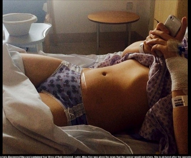 Algumas semanas depois da operação, Olivia já retornou aos esportes, e agora
planeja fazer uma caminhada e escalada de dez quilômetros 