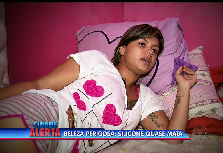 Poucos dias após a cirurgia, Marcelle já começou a sentir as primeiras dores. Após o inchaço veio a infecção e a jovem foi internada por três vezes+ Quer ver tudo o que rolou no Cidade Alerta? Veja a íntegra no R7 Play
