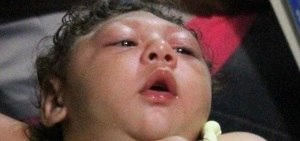 País tem 4 registros de microcefalia por hora; férias podem ampliar surto de zika